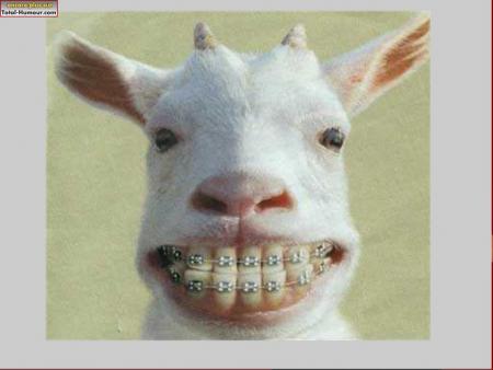 Dents de fer